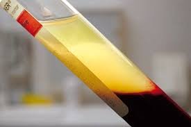 Blood plasma of recovered Covid-19 patients goes on sale in Pakistan