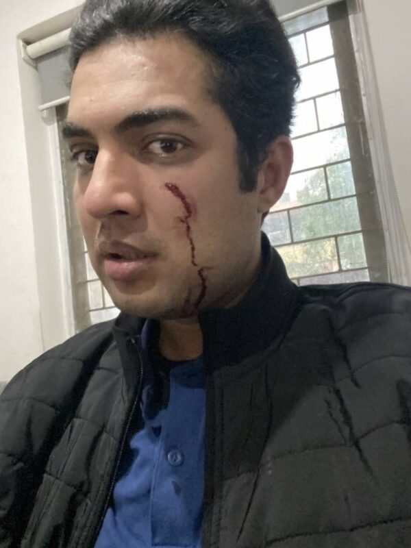 Unidentified people assault renowned journalist & TV host in Lahore iqrar3